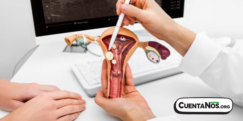 ¿Qué conoces acerca del Síndrome del Ovario Poliquístico o SOP.png
